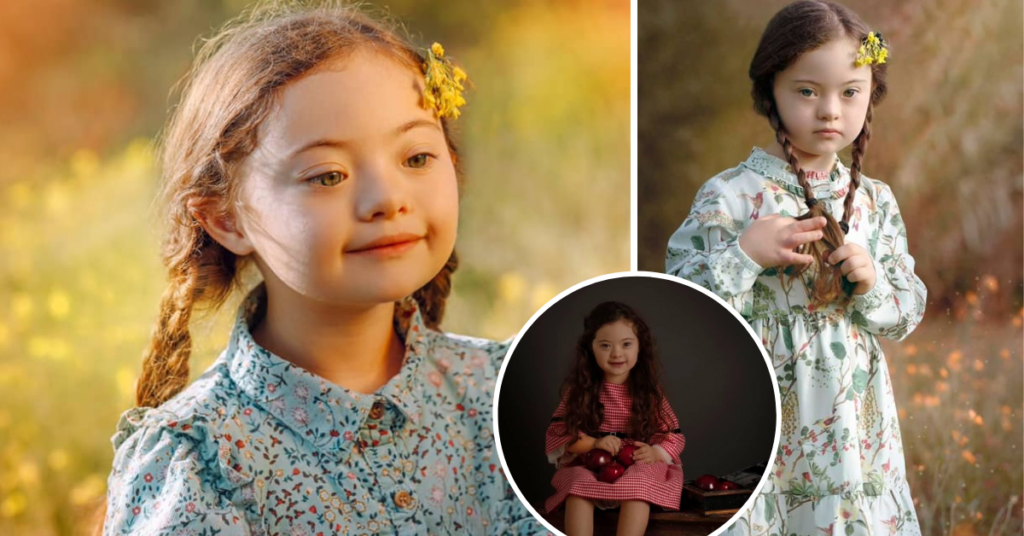 WATCH: Maltese Down Syndrome Ambassador Continues To Inspire And ...