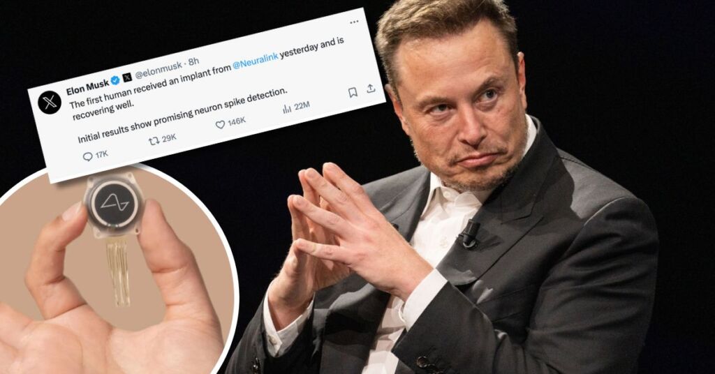 Elon Musk says first human patient received Neuralink brain